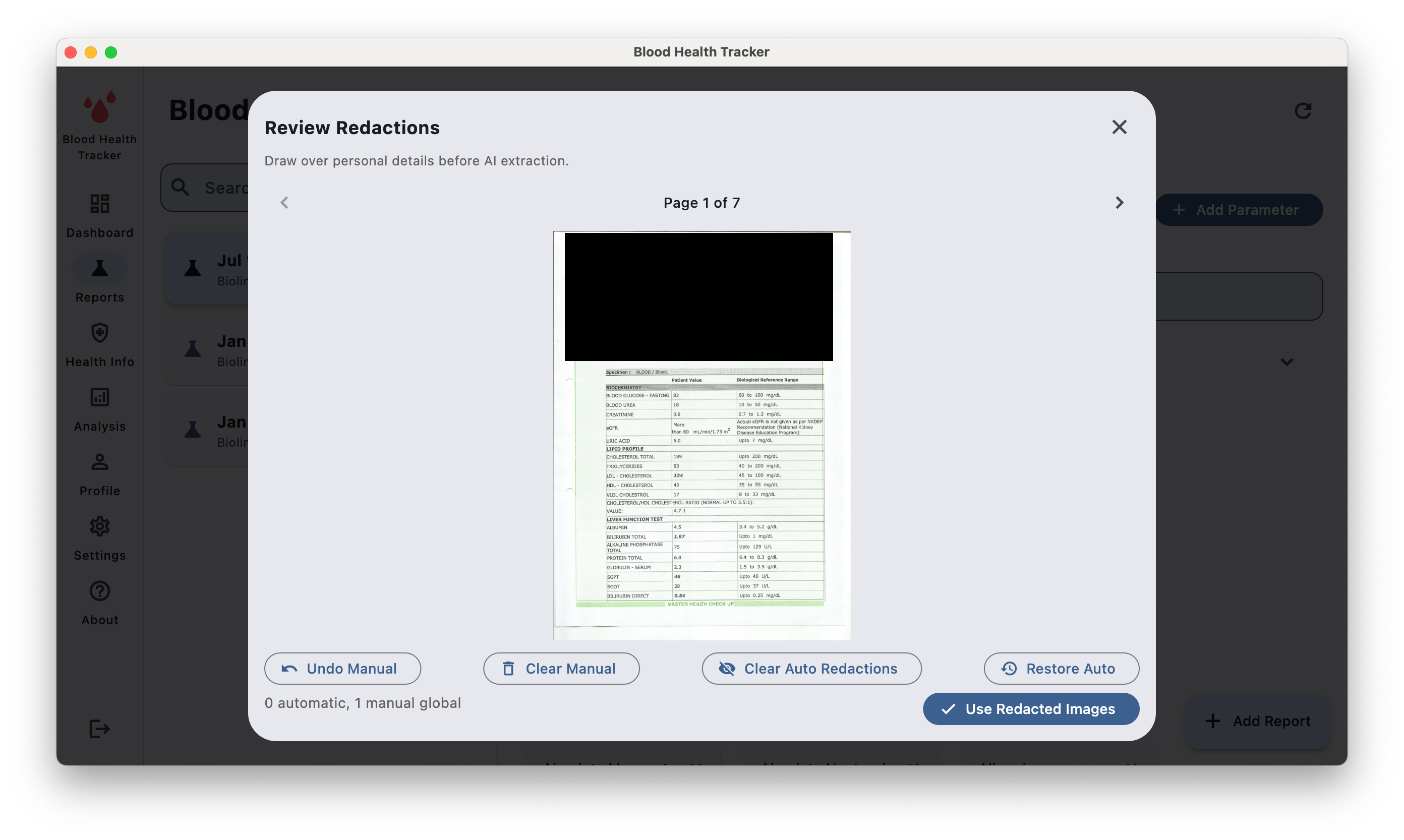 Redaction review showing personal details covered before AI extraction